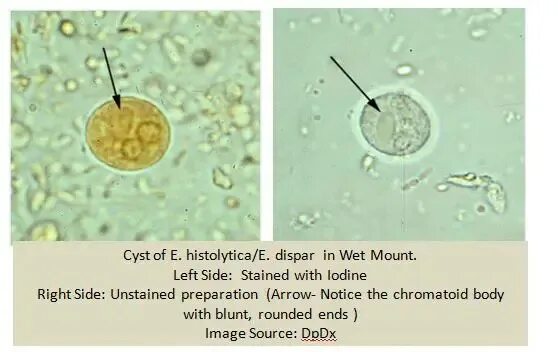 Entamoeba coli в кале. Цисты Entamoeba. Entamoeba histolytica под микроскопом. Entamoeba histolytica циста в Кале. Энтамеба коли цисты в Кале.