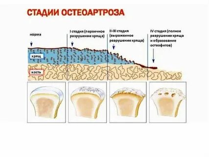 Вторичный деформирующий
