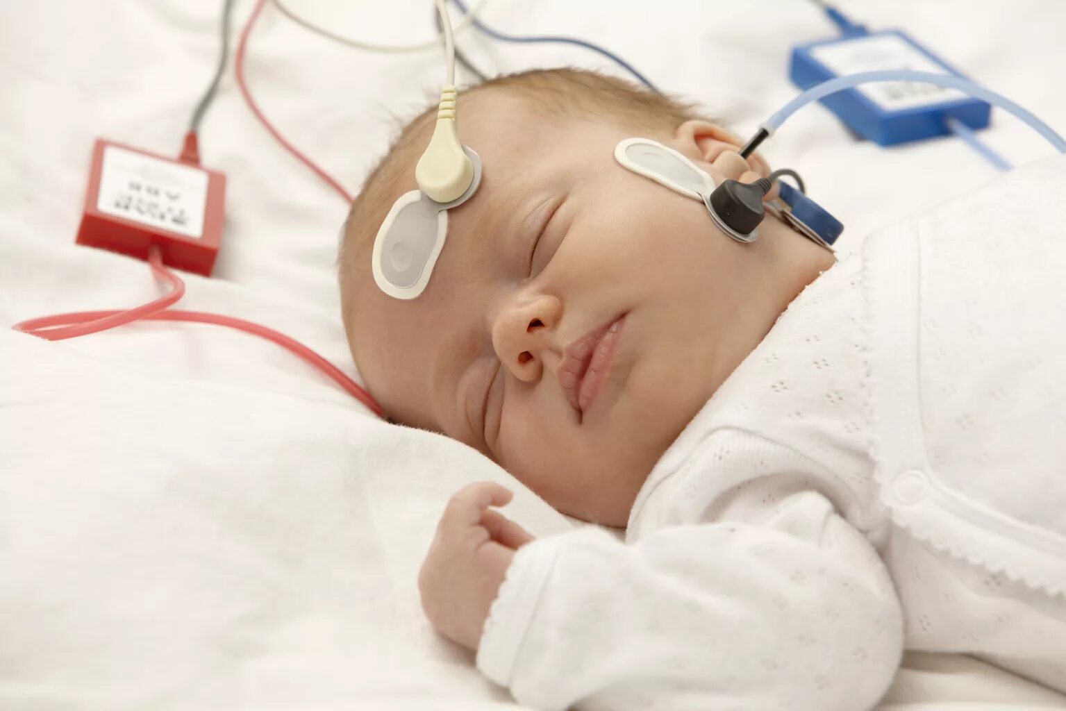 Прибор отоакустической эмиссии. Мелфон КСВП. КСВП исследование слуха у ребенка. Аудиологический скрининг новорожденных аппарат. Условно-рефлекторная аудиометрия.