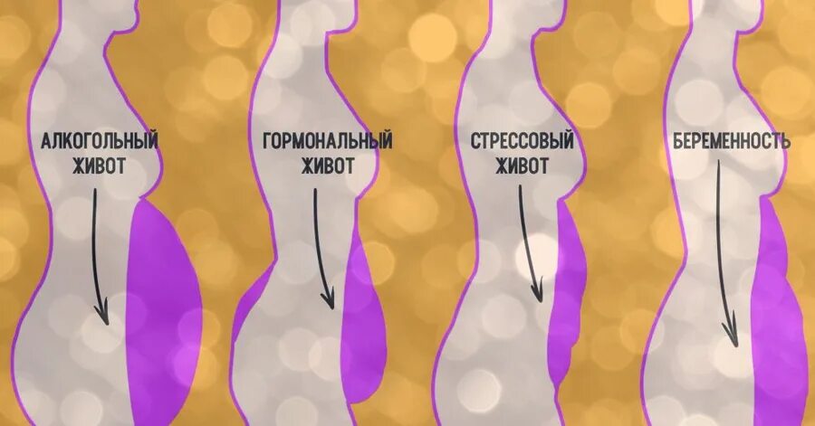 Почему у женщины растет живот после 40. Гормональный живот. формы живота у женщин. кортизоловый живот. виды живота у женщин.