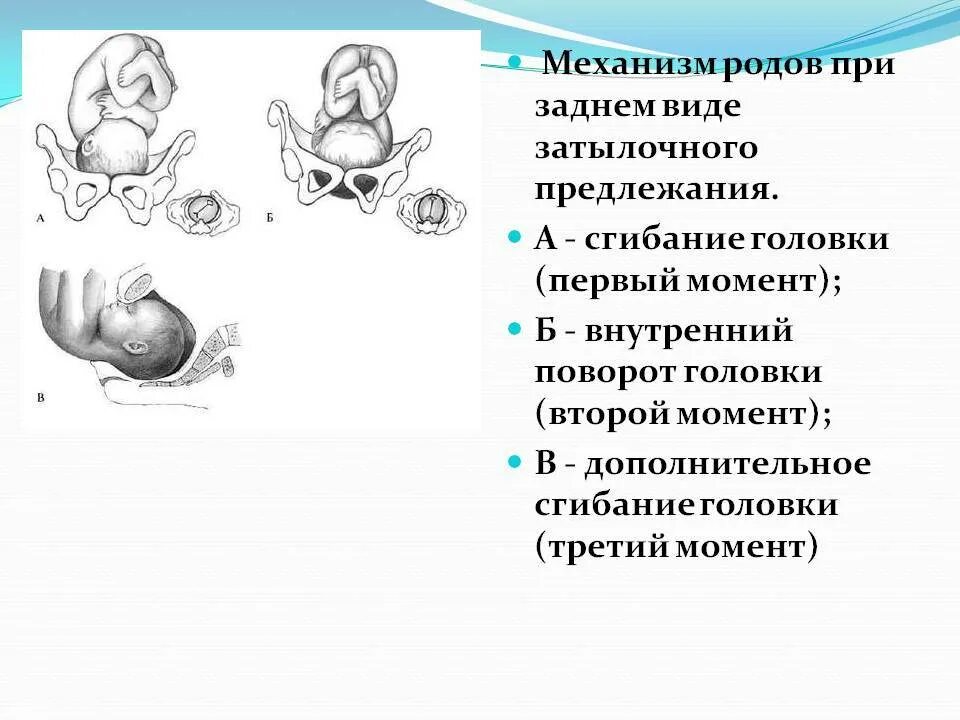 Роды при заднем затылочном предлежании