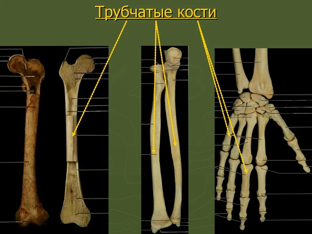 Тело длинной трубчатой кости. Трубчатый. Трубчатые кости. Длинные трубчатые кости. Строение длинной кости.