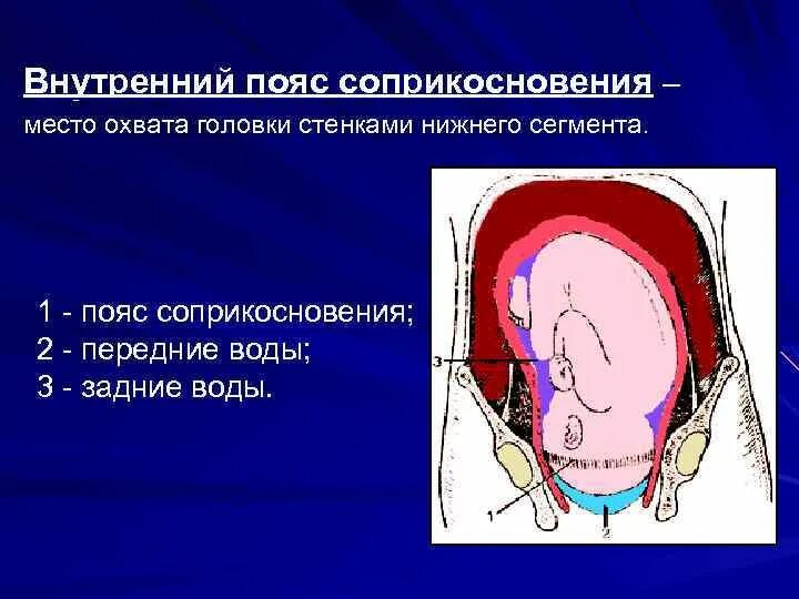 Передние и задние околоплодные воды. Внутренний пояс соприкосновения в акушерстве.