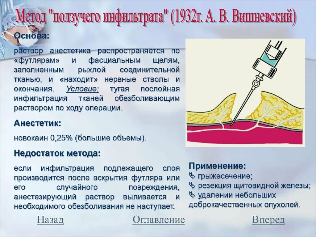 Алгоритм анестезии. Инфильтрационная анестезия по Вишневскому. Метод ползучего инфильтрата по Вишневскому. Местная анестезия по Вишневскому. Метод тугого ползучего инфильтрата.