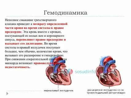 Пороки недостаточность клапана