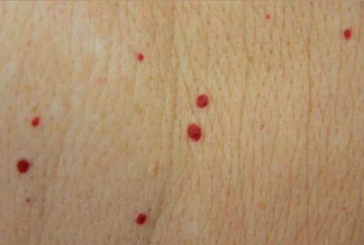 фото единичный