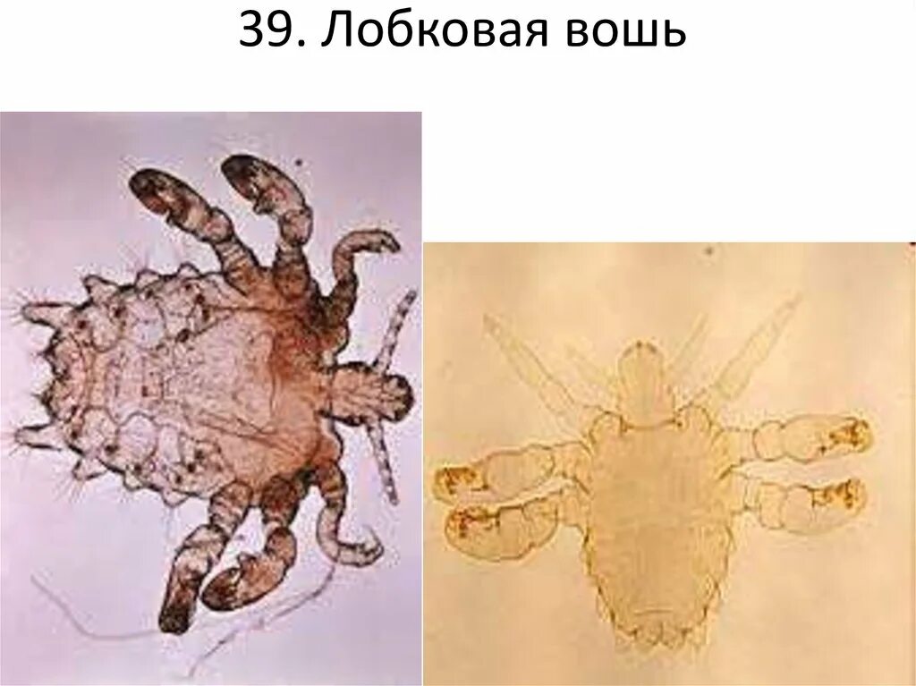 Самые длинные лобковые