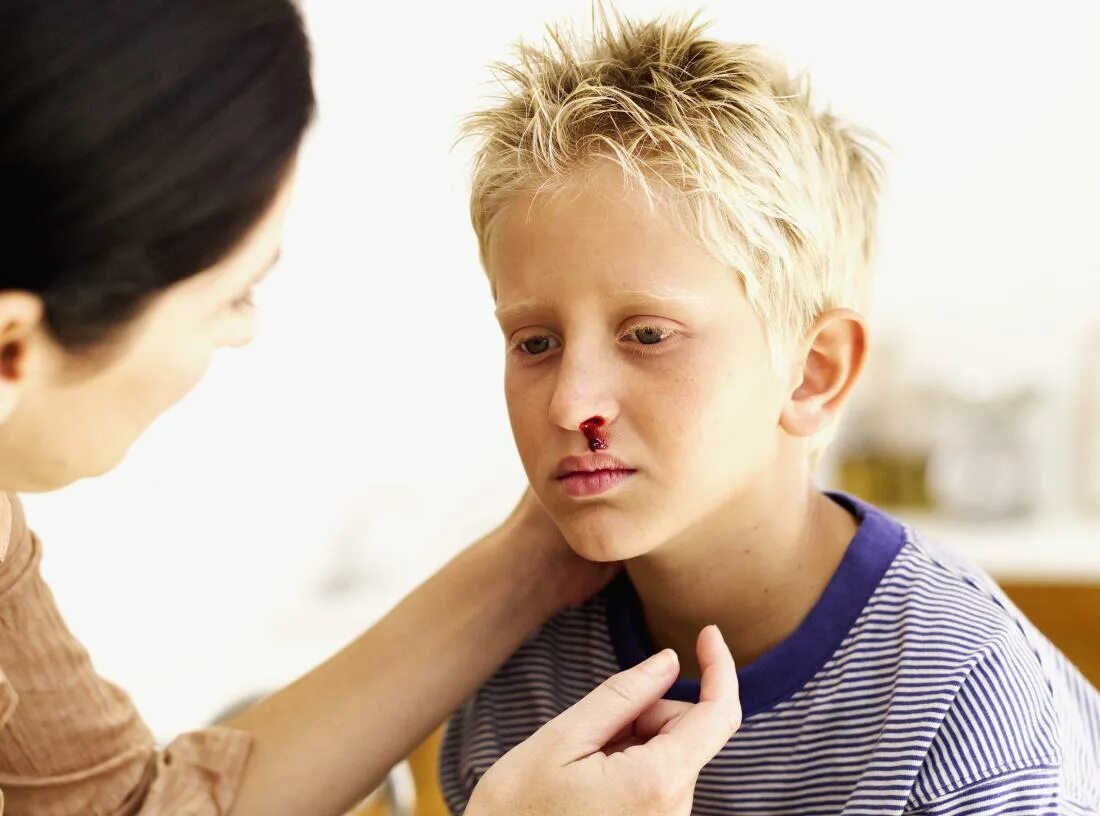 Дети больные гемофилией. Кровотечение из носа у детей.