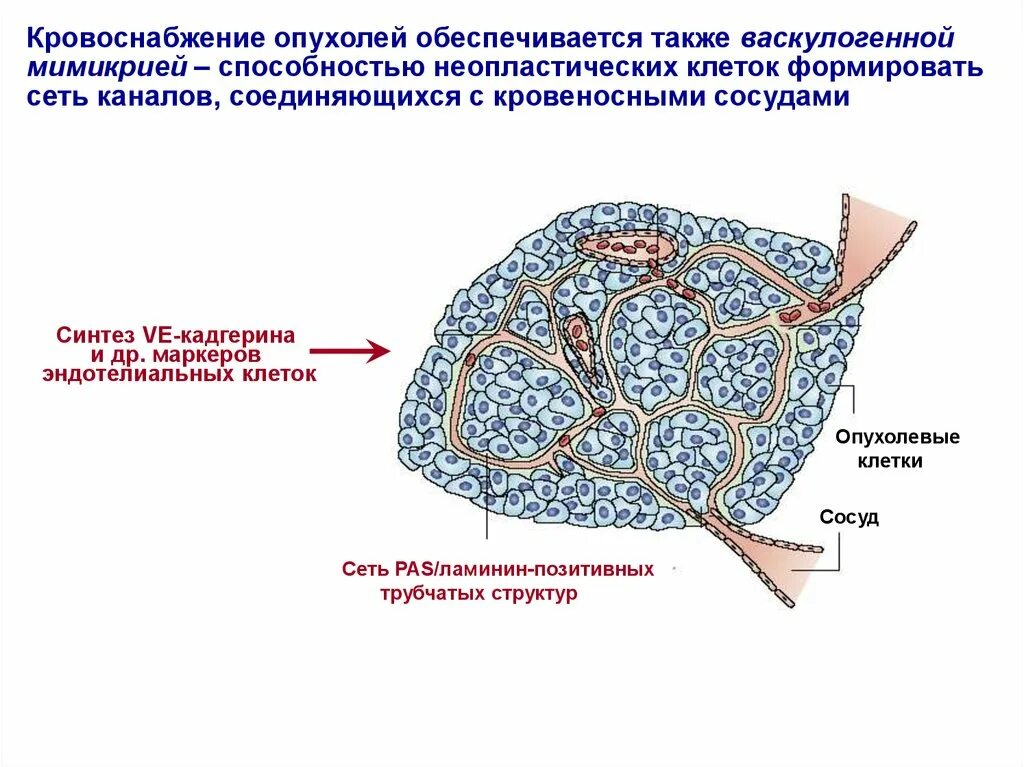 Опухоль с преобладанием стромы на ощупь