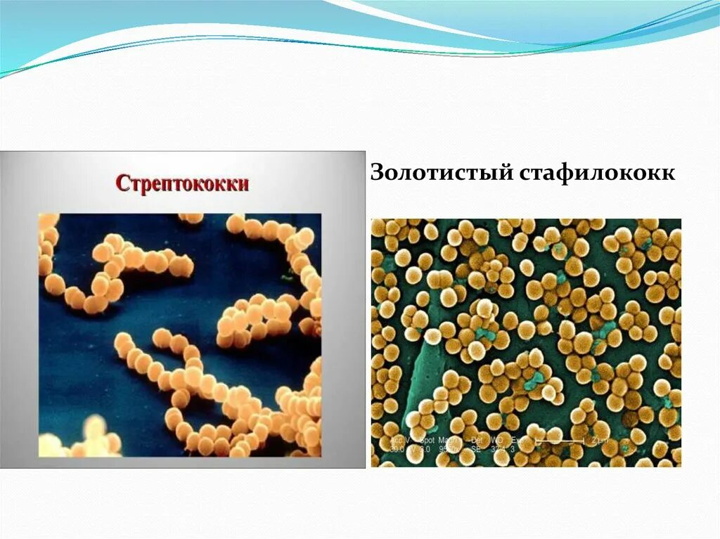 Пневмококк золотистый стафилококк. Золотистый стафилококк и стрептококк. Стафилококки стрептококки кишечная палочка. Стафилакока