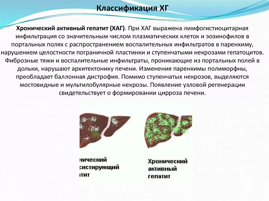 Признаки активности хронического гепатита. Активный хронический гепати. Активный гепатит. Изменение печени гепатита.