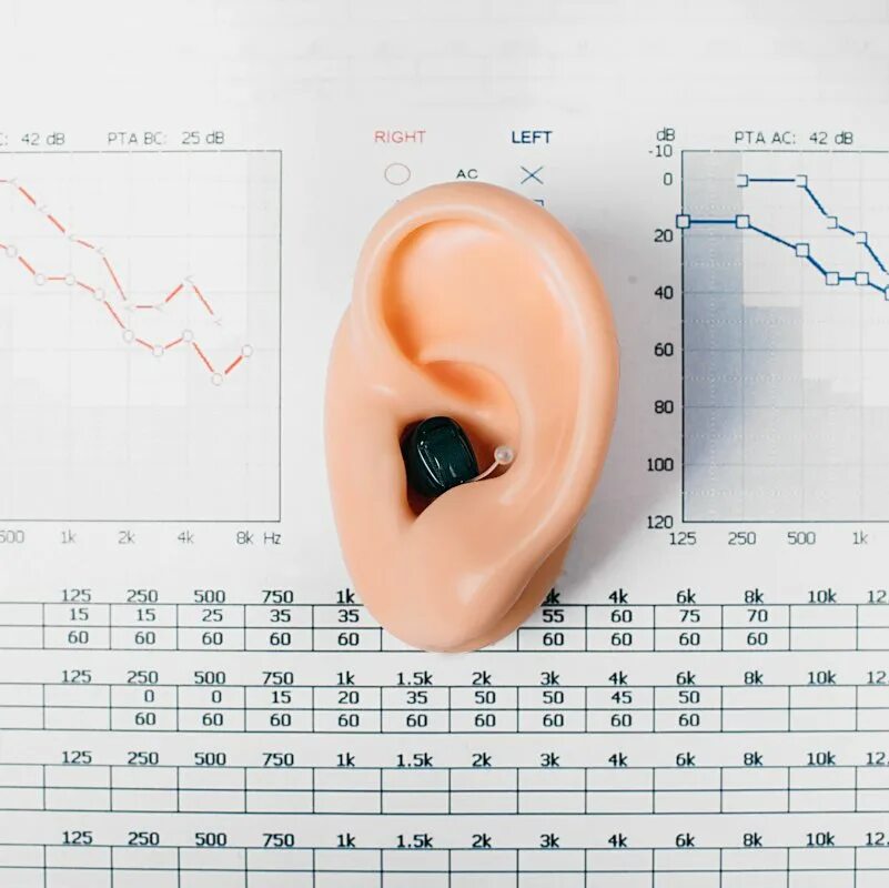 Слуховой аппарат для детей 2 степени тугоухости. Слуховой аппарат нейросенсорная тугоухость. Hearing aid слуховой аппарат. Стационарный слуховой аппарат индивидуального пользования. Старинный слуховой аппарат.