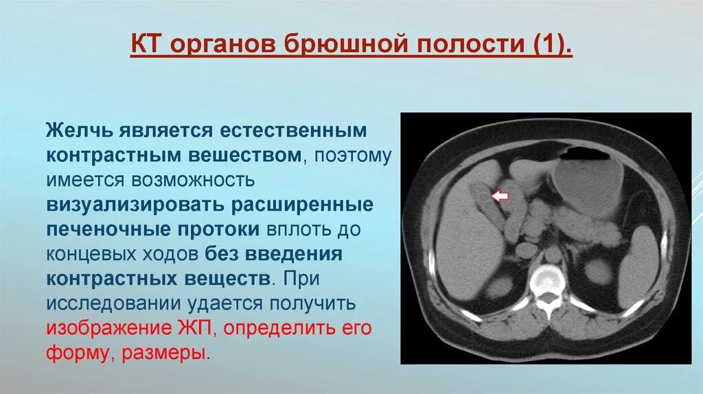 Кт брюшной полости. Кт брюшной полости и забрюшинного пространства. Кт органов брюшной полости с контрастом. Контрастное кт брюшной полости.