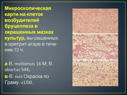 Возбудитель бруцеллеза
