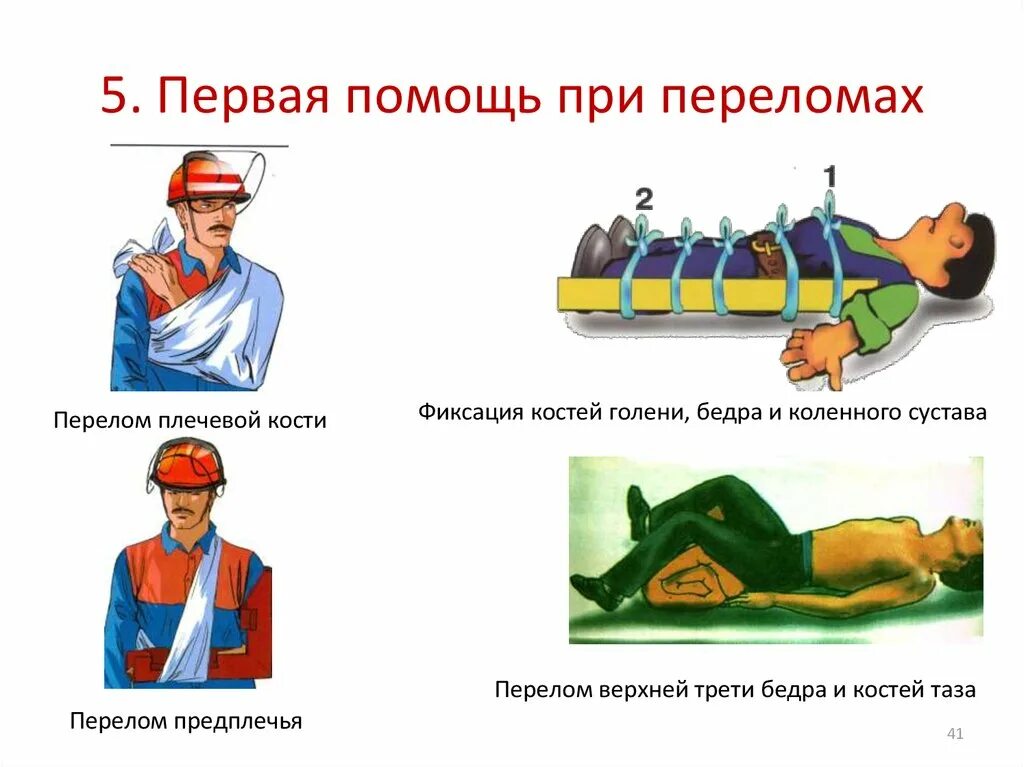 Правила при открытом переломе. Перелом и оказание первой медицинской помощи при переломе. Порядок оказания первой помощи при переломах костей. Перелом ПМП при переломах. Оказание первой помощи при переломах кратко.