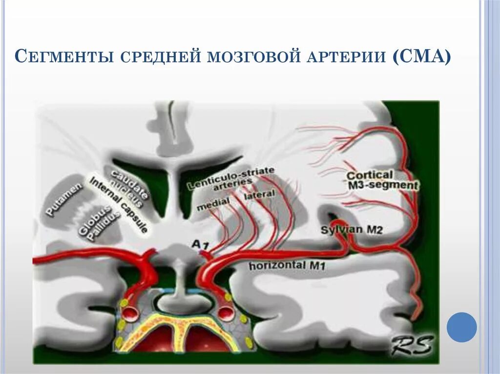 Передняя мозговая артерия сегменты а1. М1 сегмент средней мозговой артерии. средняя мозговая артерия м1. м2 сегмент правой средней мозговой артерии. анатомия средней мозговой артерии сегменты.
