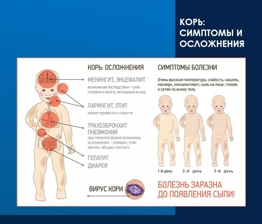 Как перенесли корь. Как перенесли корь