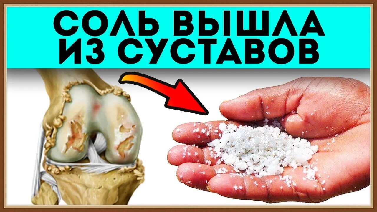 Как бороться с отложением солей. Отложение солей в суставах.