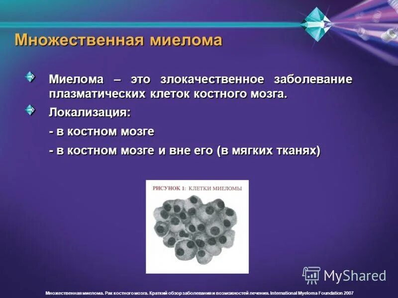 Миеломная болезнь формы заболевания. Множественная миелома локализация. Миелома диффузно очаговая форма. Миеломная болезнь плазматические клетки. Множественные злокачественные