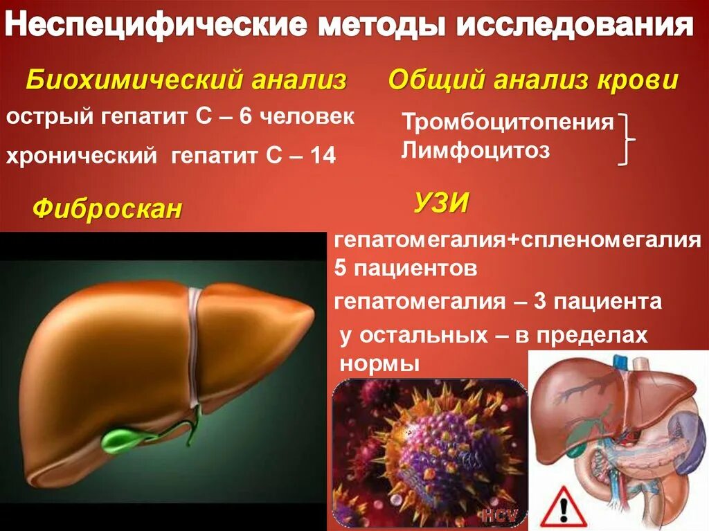 Операция при гепатите с. Гепатит биохимия. Острый и хронический гепатит. Методы исследования гепатита а.