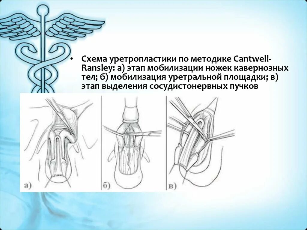 Открытая головка мужчины