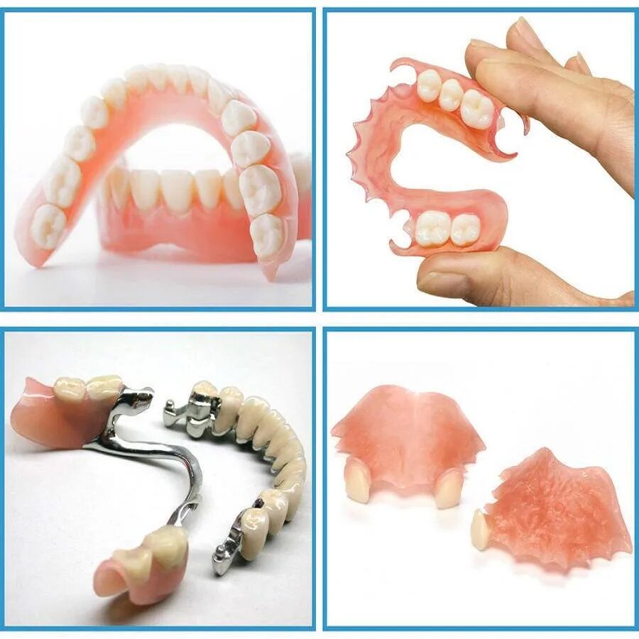 Через сколько можно вставлять зубы. Частичный съемный протез Flexi n512. Полносъемные протезы ортопедическая стоматология.