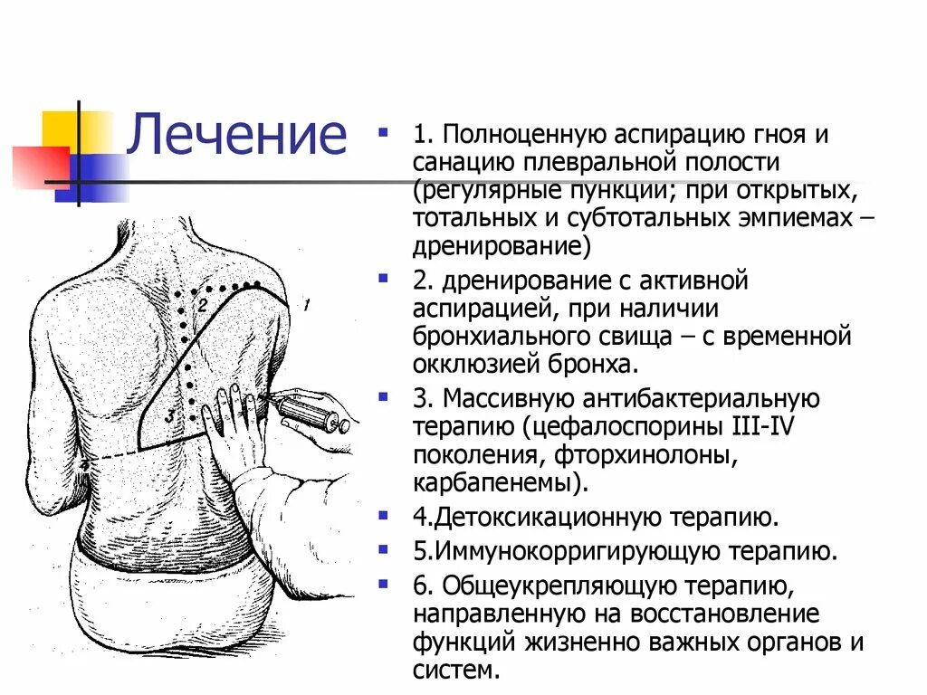 Точка пункции при эмпиеме плевральной полости. Пункция при эмпиеме плевры. Плевральная пункция при эмпиеме. Дренирование эмпиемы плевры.