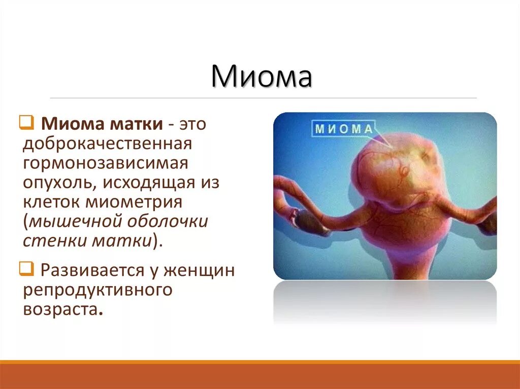 Формы миомы матки