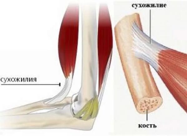 Сухожилия прикрепляются