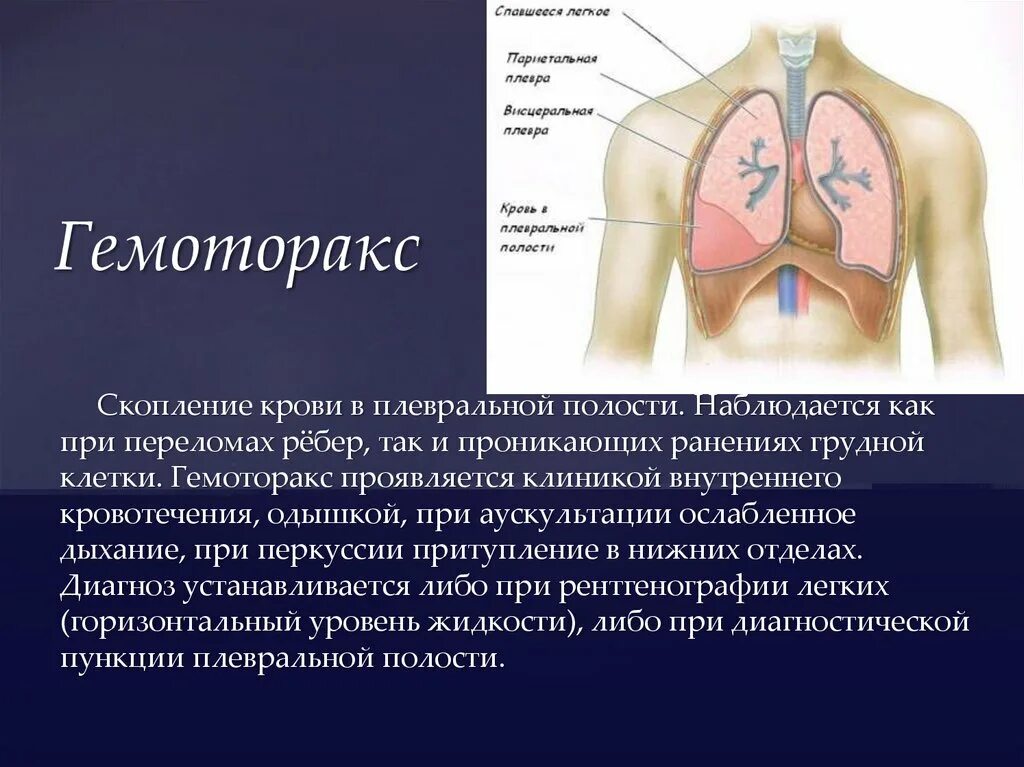 Паракостальный гемоторакс?. Травмы груди гемоторакс. Плевральный гемоторакс. Гемоторакс презентация.