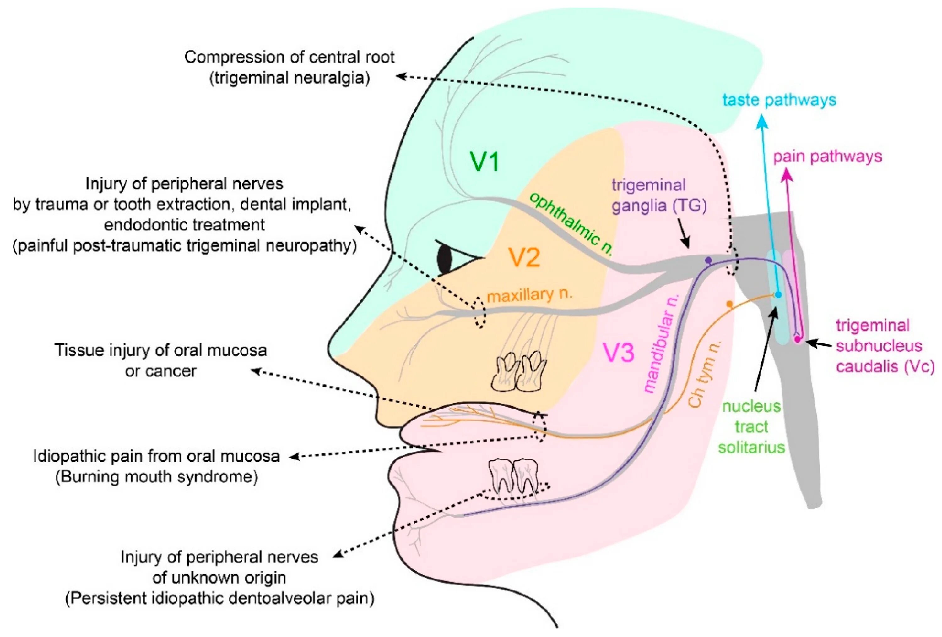 Neuralgia латынь