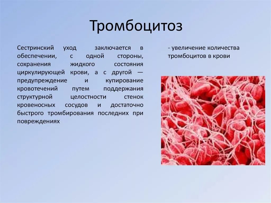 Заболеваниях крови уход. Тромбоцитоз. Заболевания при тромбоцитозе. Тромбоцитоз симптомы. Тромбоцитоз причины.