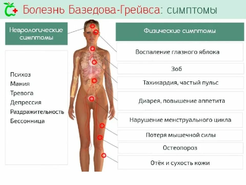 Болезнь и т п. Клинические симптомы базедовой болезни. Базедова болезнь проявления. Болезнь Грейвса симптомы. Болезнь Грейвса базедова симптомы.