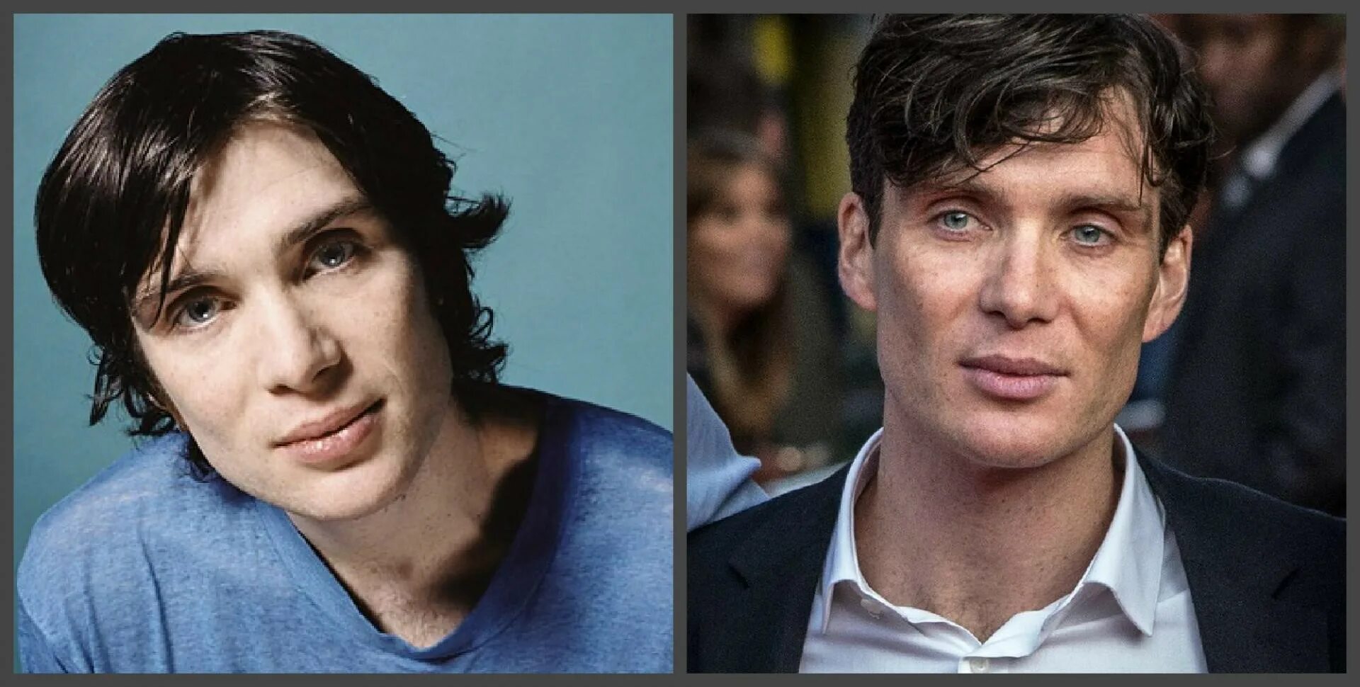 Киллиан мёрфи до пластики. Киллиан мёрфи до пластики. Киллиан мерфи жена после пластики. Киллиан мерфи жена после пластики. Киллиан мерфи жена после пластики.