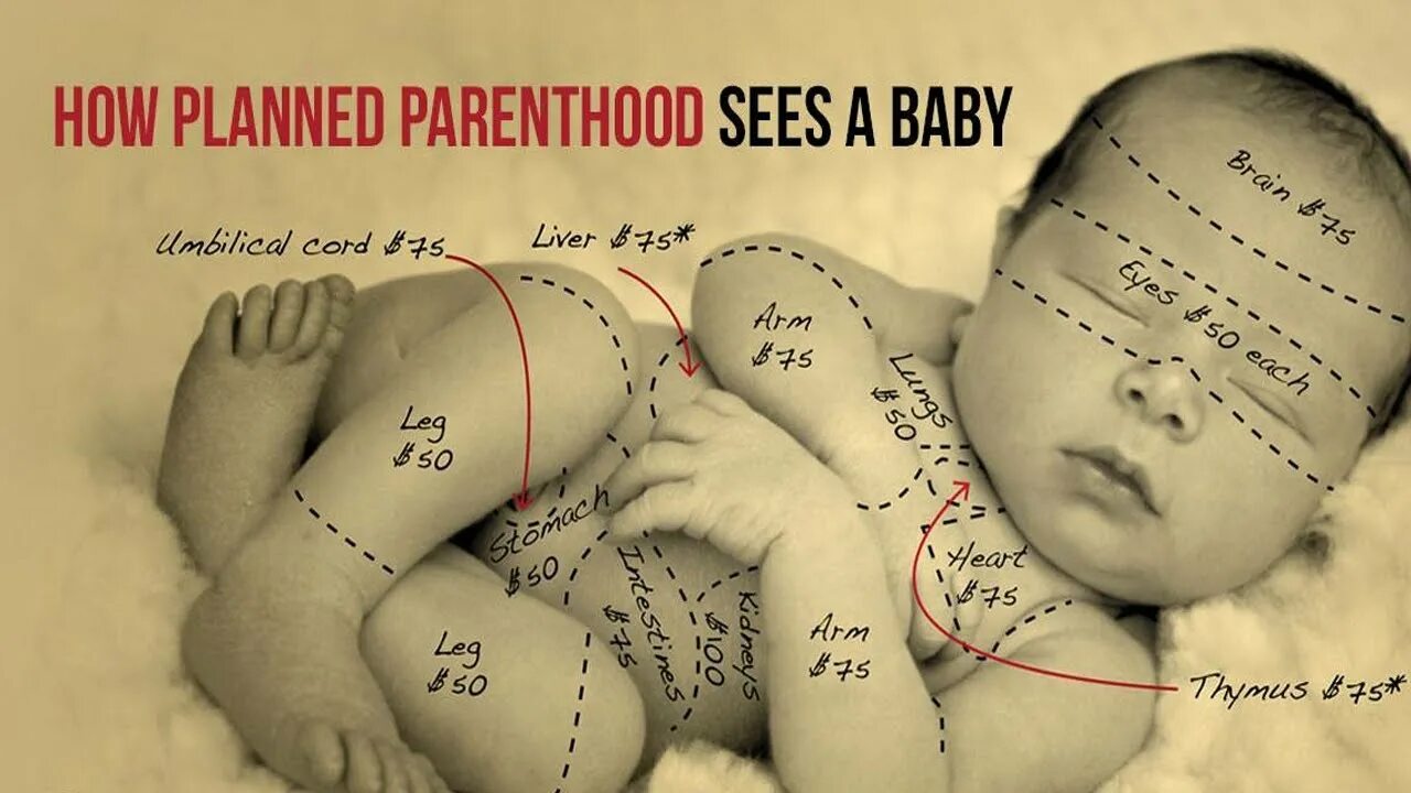 From planned ones. Planned Parenthood. Planned Parenthood mem.