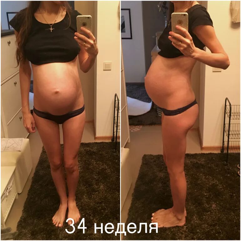Беременность 34 2 недели. 34 Неделя беременности фото. Отёки на 34 неделе беременности.