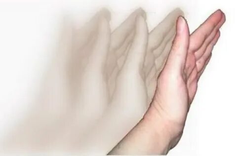 Moved hand