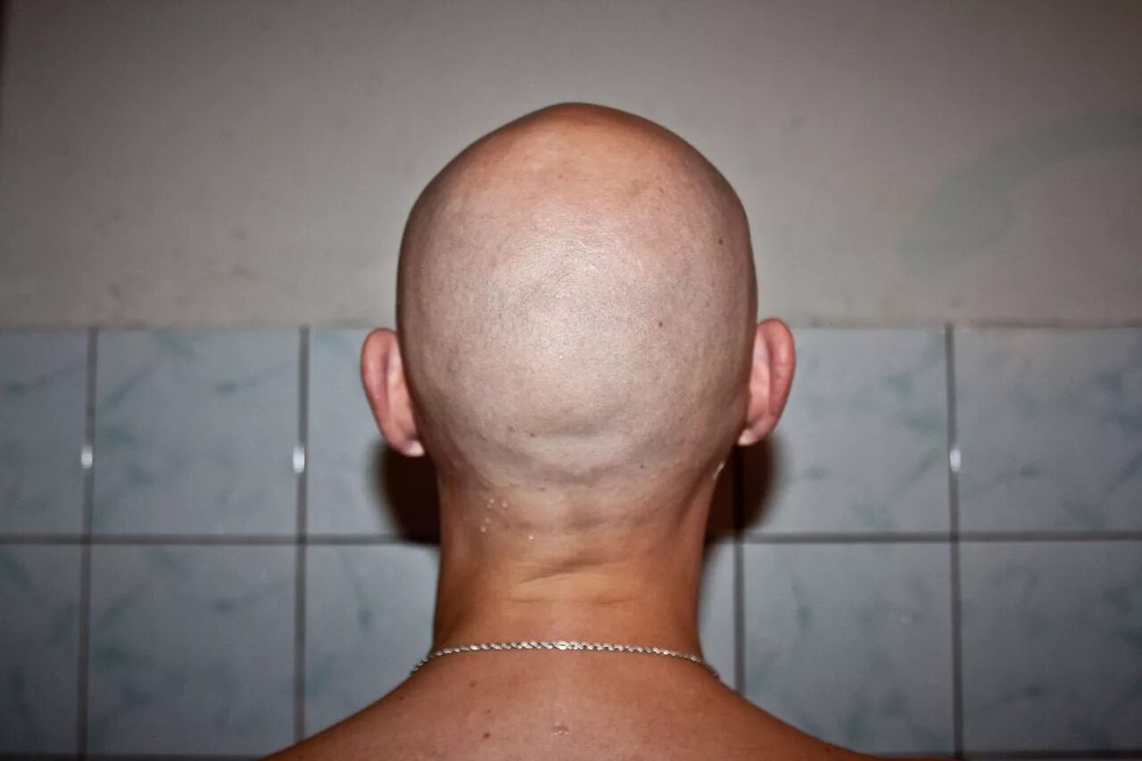мужские прически затылок. Bald head сзади. затылок. лысый затылок. лысые головы.