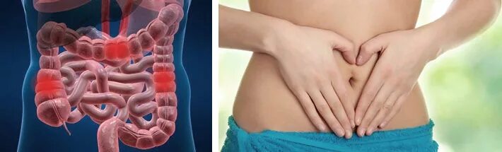 Дисбактериоз (микробиоценоз кишечника). Кишечная проблема. Дискомфорт в животе. Болезни тонкой кишки симптомы. Заболевания тонкого кишечника симптомы.