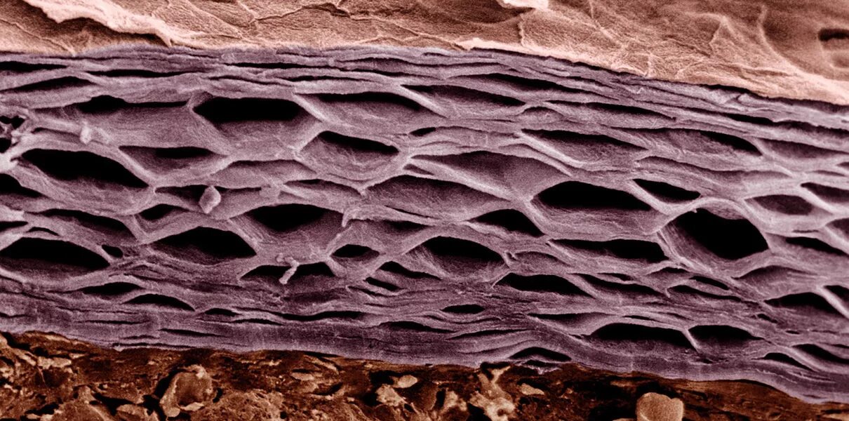 Кожные роговые образования это. Роговой слой эпидермиса под микроскопом. Десквамация эпидермиса. Ороговевшие чешуйки эпидермиса. Клетки кожи под микроскопом.