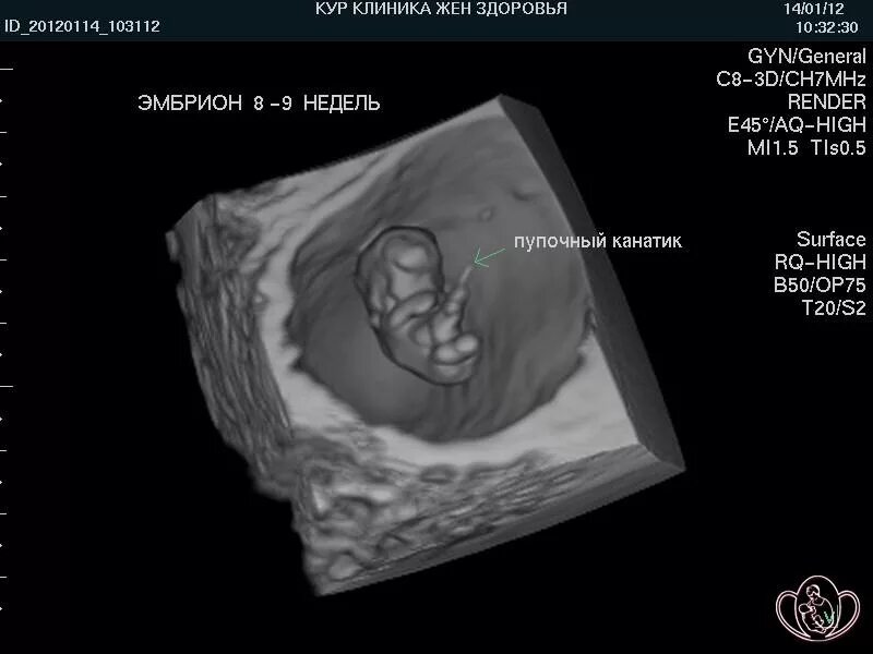 Размер плода акушерских недель. Эмбрион на 9 акушерской неделе беременности УЗИ. Плод на 9 неделе беременности по УЗИ. УЗИ плода на 9 акушерской неделе беременности. Эмбрион на 8-9 неделе беременности УЗИ.