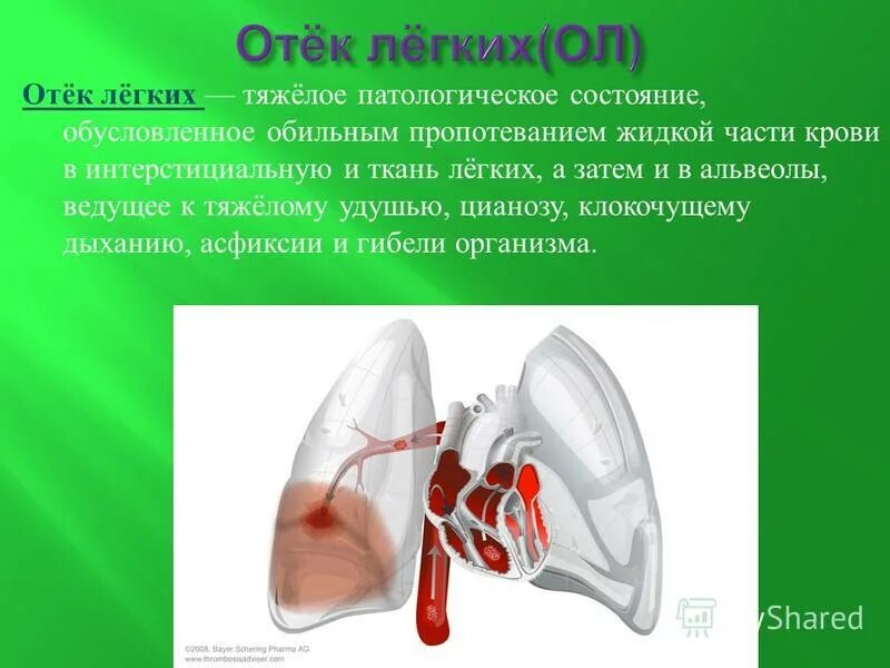 Отек легких обусловлен увеличением количества крови в. Отек легких механизм