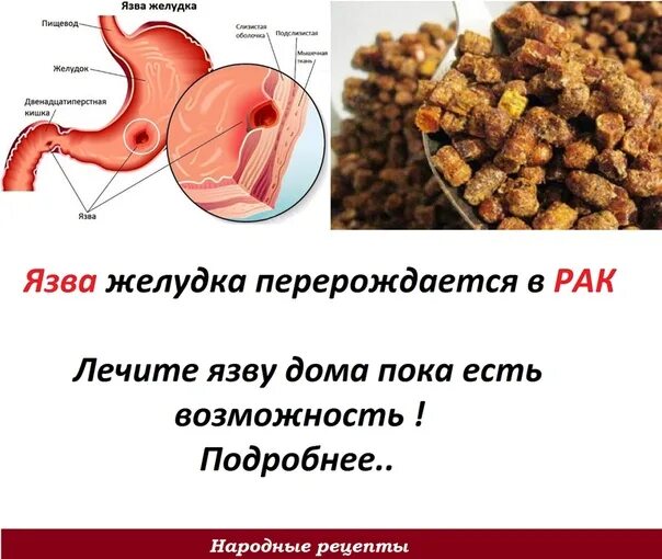 Стоит желудок что делать как запустить. Голодный желудок. постоянная боль в желудке.