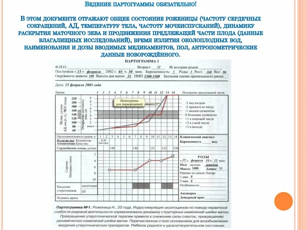 Партограмма. Партограмма в акушерстве норма. Программа акушерство. Партограмма в акушерстве бланк. Пример партограммы.