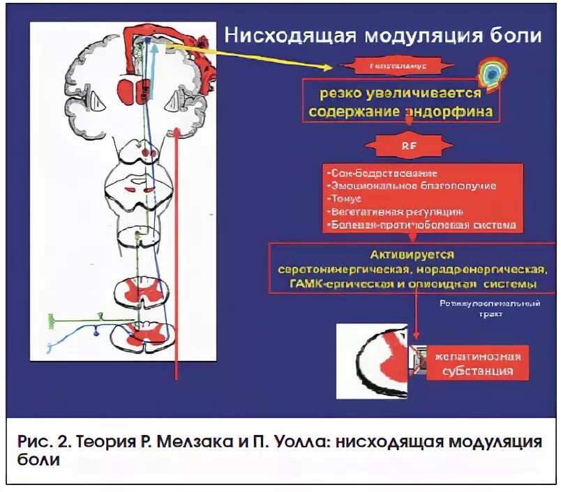 Нисходящая система. Нисходящая модуляция боли. Нисходящий контроль болевой чувствительности. Нисходящий контроль болевой чувствительности схема. Ноцицептивная и антиноцицептивная системы.