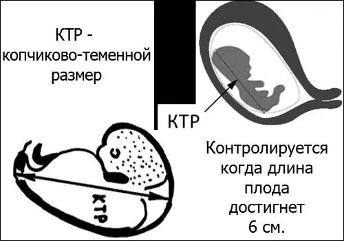 Ктр прочее. Копчико-теменной размер плода (КТР). Копчико-теменной размер в 12 недель норма. Нормы КТР плода по неделям. КТР плода по УЗИ неделям беременности.