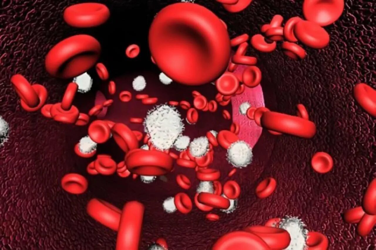 Гемоглобин при заболеваниях крови. Анемия иллюстрация. Дефицитные анемии.