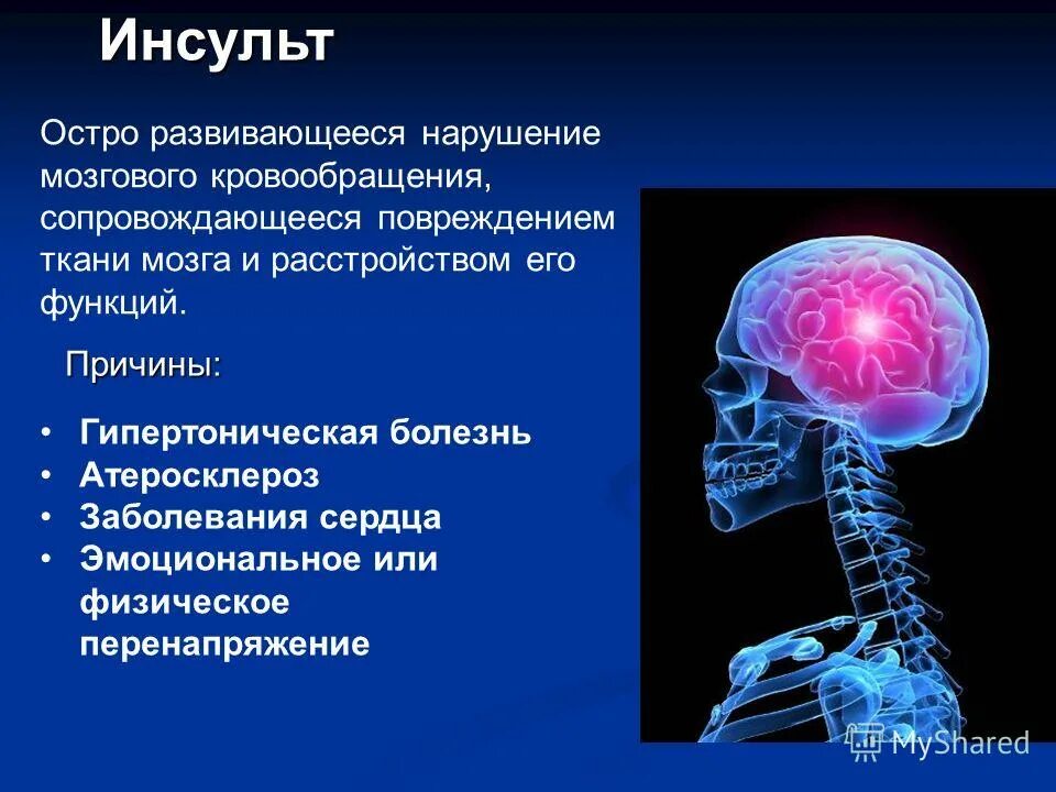 Спинальный инсульт что это симптомы и лечение. Нарушение центральной нервной системы. Острые заболевания центральной нервной системы. Инсульт нервной системы. Презентация на тему инсульт.