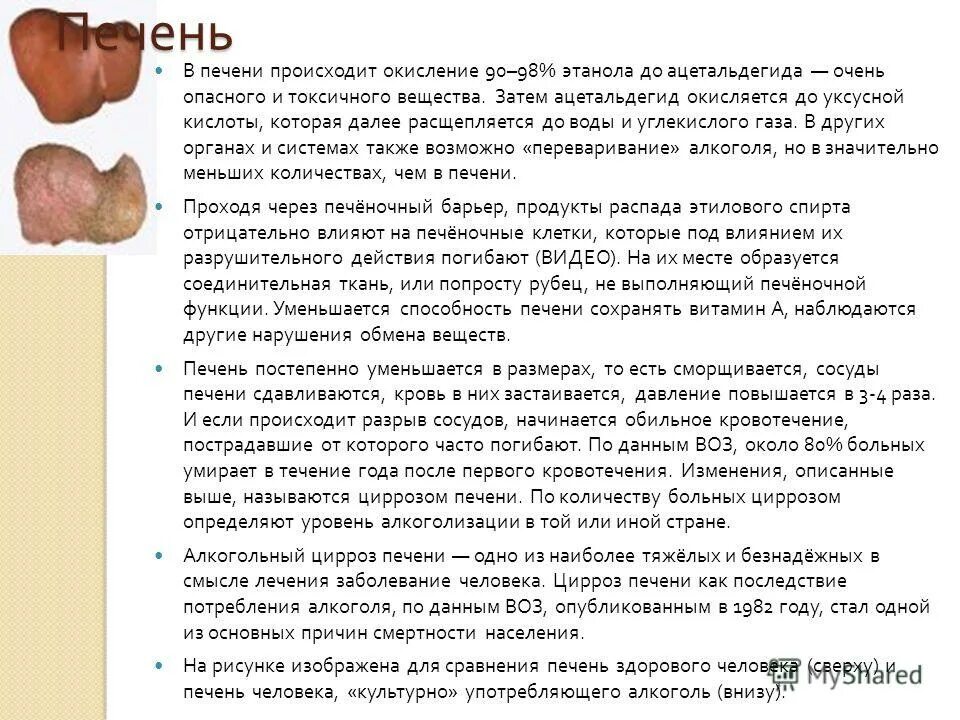 Функции печени анатомия. Процессы в печени. Функции печени анатомия. Функции печени кратко и понятно. Что происходит в печени.