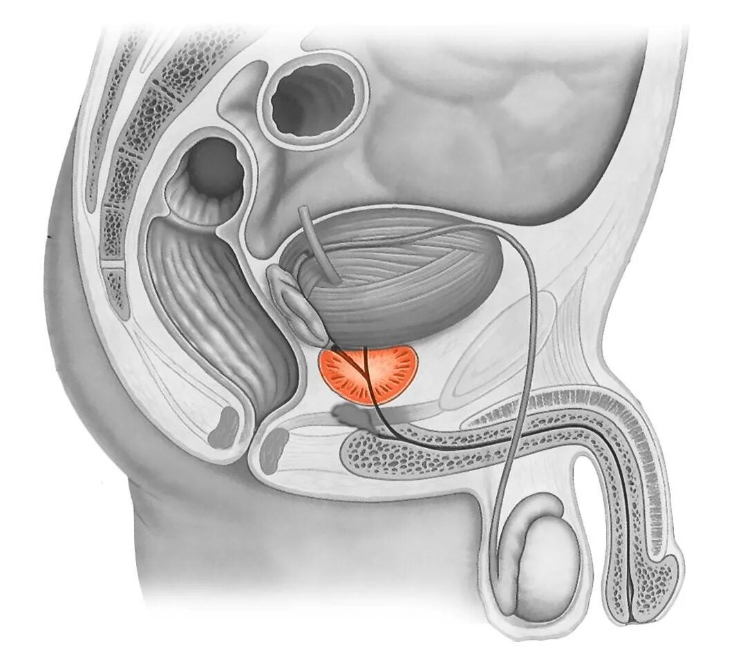 Простату телефон. Предстательная железа, Prostata. Простата и предстательная железа. Анатомия аденомы предстательной железы. Мочевой пузырь предстательная железа анатомия.